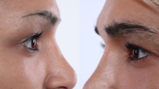 Before And After: How Vegamour Helped Grow My Eyebrows Naturally