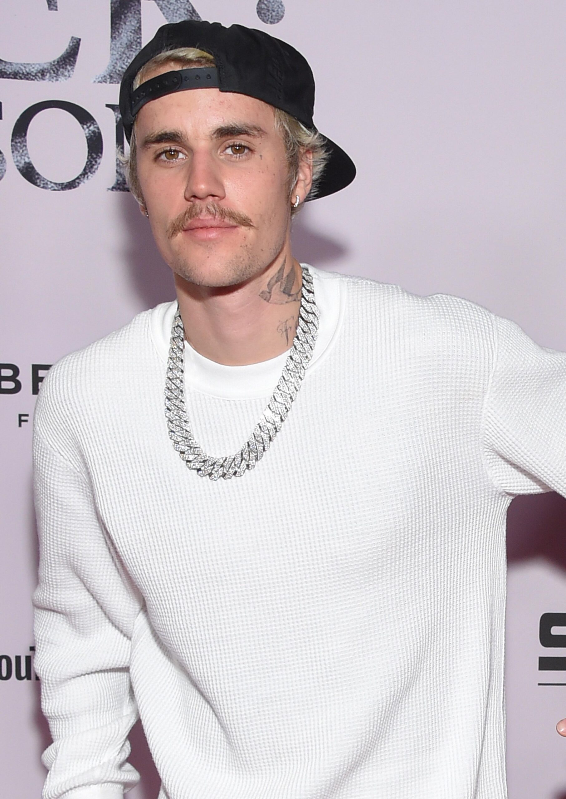 What’s With Justin Bieber’s Pimple Patches?